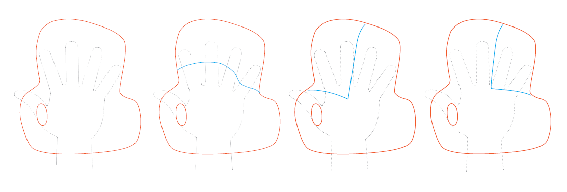 Manosplint Predecoupes